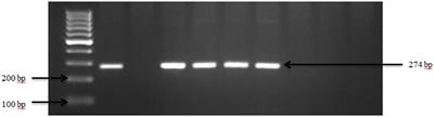 Antibiogram profiles of pathogenic and commensal bacteria in goat and sheep feces on smallholder farm